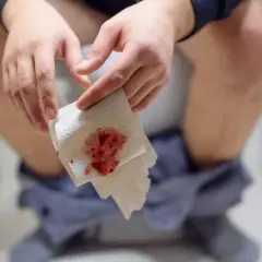 Dłoń trzymająca papier toaletowy z widoczną krwią. To może być objaw problemów zdrowotnych, takich jak krew w stolcu.